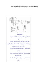 Tài liệu Xoa bóp hỗ trợ điều trị bệnh đái tháo đường pptx