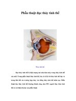 Tài liệu Phẫu thuật đục thủy tinh thể pdf
