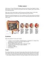 Tài liệu Colon cancer pdf