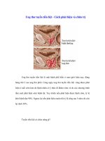 Tài liệu Ung thư tuyến tiền liệt - Cách phát hiện và chữa trị ppt