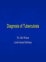 Diagnosis of Tuberculosis Dr. John Watson Leeds General Infirmary doc