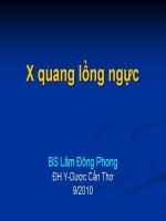 X quang lồng ngực pptx