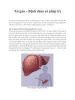 Xơ gan – Bệnh chưa có phép trị doc