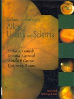 Sankara Nethralaya''s Atlas of Uveitis and Scleritis pptx