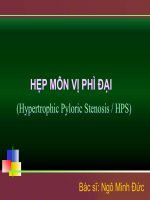 HẸP MÔN VỊ PHÌ ĐẠI potx