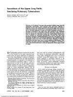 Sarcoidosis of the Upper Lung Fields Simulating Pulmonary Tuberculosis pptx