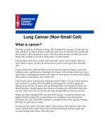 Lung Cancer (Non-Small Cell) pptx