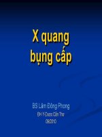 X quang bụng cấp ppt