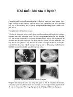 Khó nuốt, khi nào là bệnh? ppt