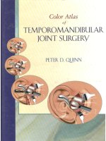 color atlas of temporomandibular joint surgery  -  p. quinn
