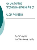 giả ung thư phổi tương quan giữa hình ảnh ct và giải phẫu bệnh