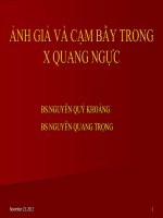 ảnh giả và cạm bẩy trong x quang ngực