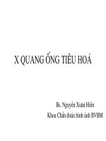 X-Quang Ống Tiêu Hóa