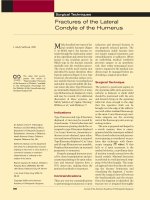 Gãy xương cánh tay pot