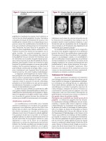 Les troubles de l’intégration visuelle - part 8 docx