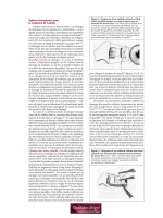 Les troubles de l’intégration visuelle - part 9 pot