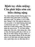 Bệnh tay chân miệng: Cần phát hiện sớm các biến chứng nặng pdf