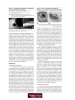 Les troubles de l’intégration visuelle - part 4 potx