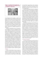 Les troubles de l’intégration visuelle - part 2 doc