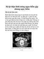 Một dị tật bẩm sinh pot