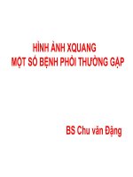 XQ Phổi Thường Gặp