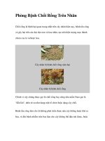 Phòng Bệnh Chổi Rồng Trên Nhãn ppt