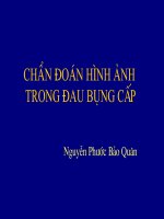 chẩn đoán hình ảnh trong đau bụng cấp