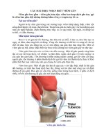 CÁC DẤU HIỆU NHẬN BIẾT VIÊM GÂN pot