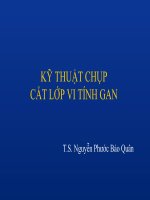 KỸ THUẬT CLVT GAN doc