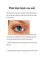 Phát hiện bệnh của mắt docx