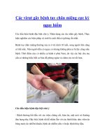 Các virut gây bệnh tay chân miệng cực kỳ nguy hiểm potx