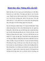 Bệnh thủy đậu: Những điều cần biết pptx