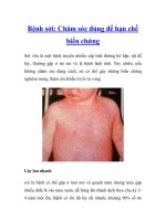 Bệnh sởi: Chăm sóc đúng để hạn chế biến chứng potx