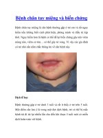 Bệnh chân tay miệng và biến chứng doc