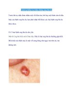 Cách tự kiểm tra triệu chứng ung thư da doc