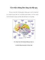 Các triệu chứng lâm sàng của đột quỵ potx