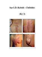 Sẹo Lồi (Keloid - Chéloïde) (Kỳ 3) docx