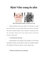 Bệnh Viêm xoang do nấm potx