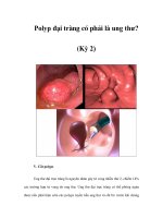 Polyp đại tràng có phải là ung thư? (Kỳ 2) doc