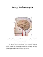 Đột quỵ do tổn thương não doc