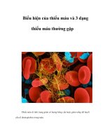 Biểu hiện của thiếu máu và 3 dạng thiếu máu thường gặp doc