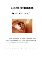 Làm thế nào phát hiện bệnh cườm nước? docx