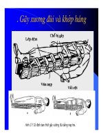 Kỹ Thuật Cố Định Tạm Thời Xương Gãy (Phần 5) ppsx