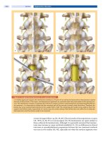 Spinal Disorders: Fundamentals of Diagnosis and Treatment Part 55 doc