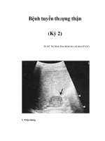 Bệnh tuyến thượng thận (Kỳ 2) pptx