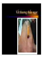 Sơ cứu và cấp cứu chấn thương trước khi đến viện (Phần 4) ppsx