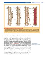 Spinal Disorders: Fundamentals of Diagnosis and Treatment Part 66 potx