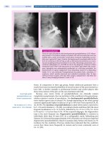 Spinal Disorders: Fundamentals of Diagnosis and Treatment Part 75 doc
