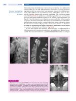 Spinal Disorders: Fundamentals of Diagnosis and Treatment Part 87 potx