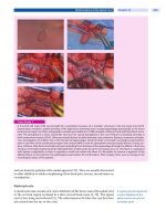 Spinal Disorders: Fundamentals of Diagnosis and Treatment Part 82 doc